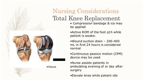 postoperative nursing care after total knee replacement ppt|Total knee replacement (tkr) ppt .